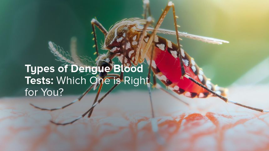 Types of Dengue Blood Tests and Choosing the Right One for You